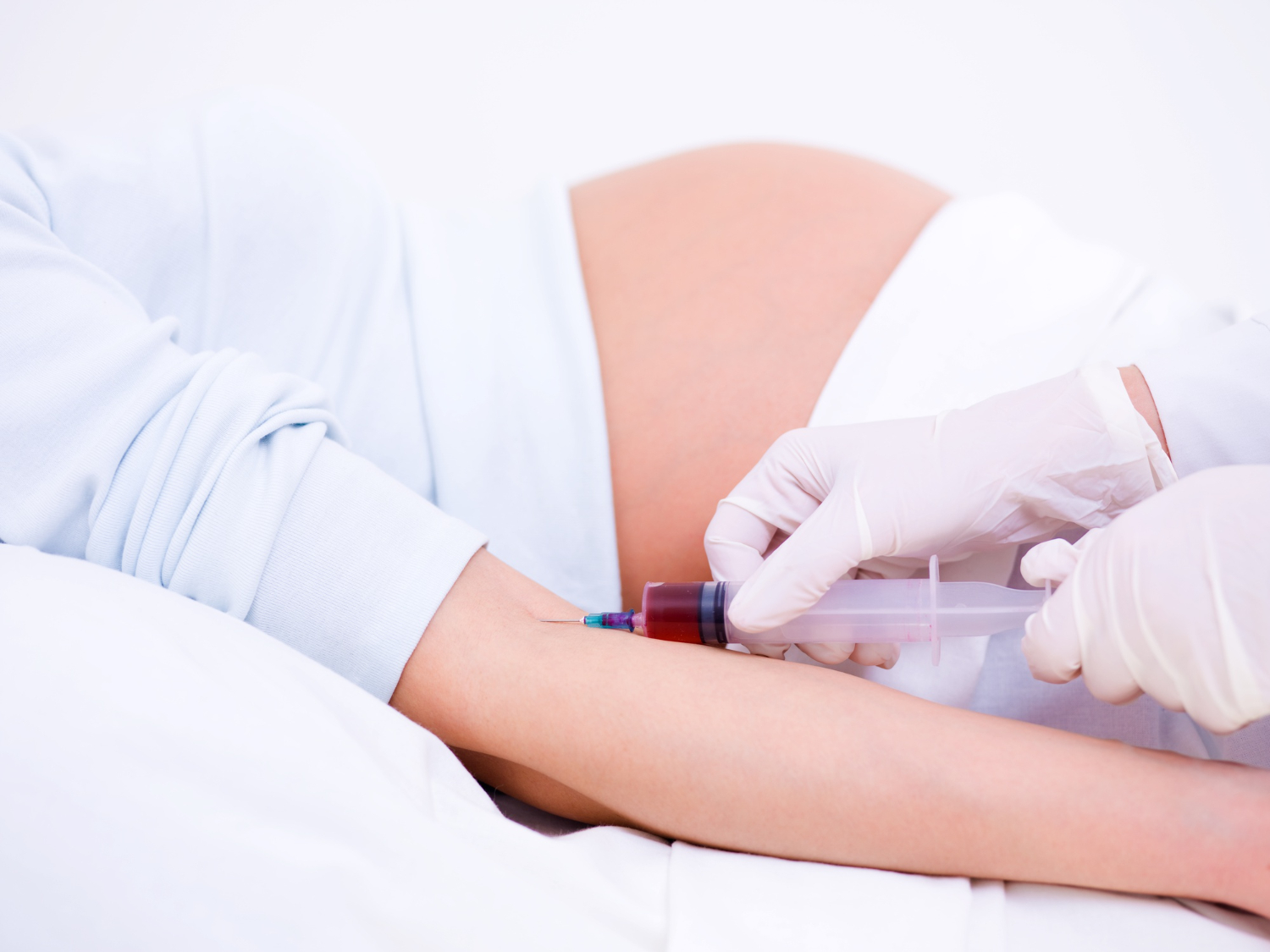 驗血辨識早產風險？