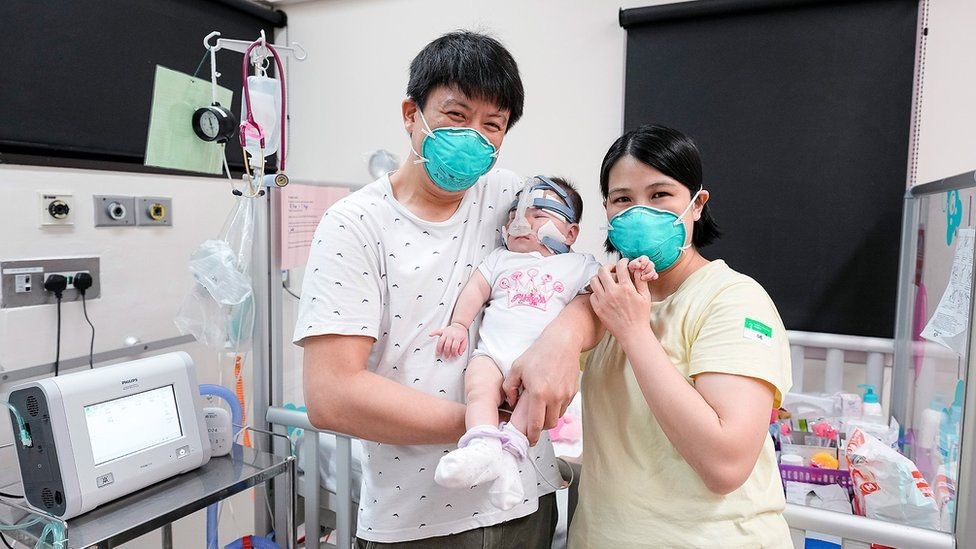 世界上最小的新生兒 出院了！