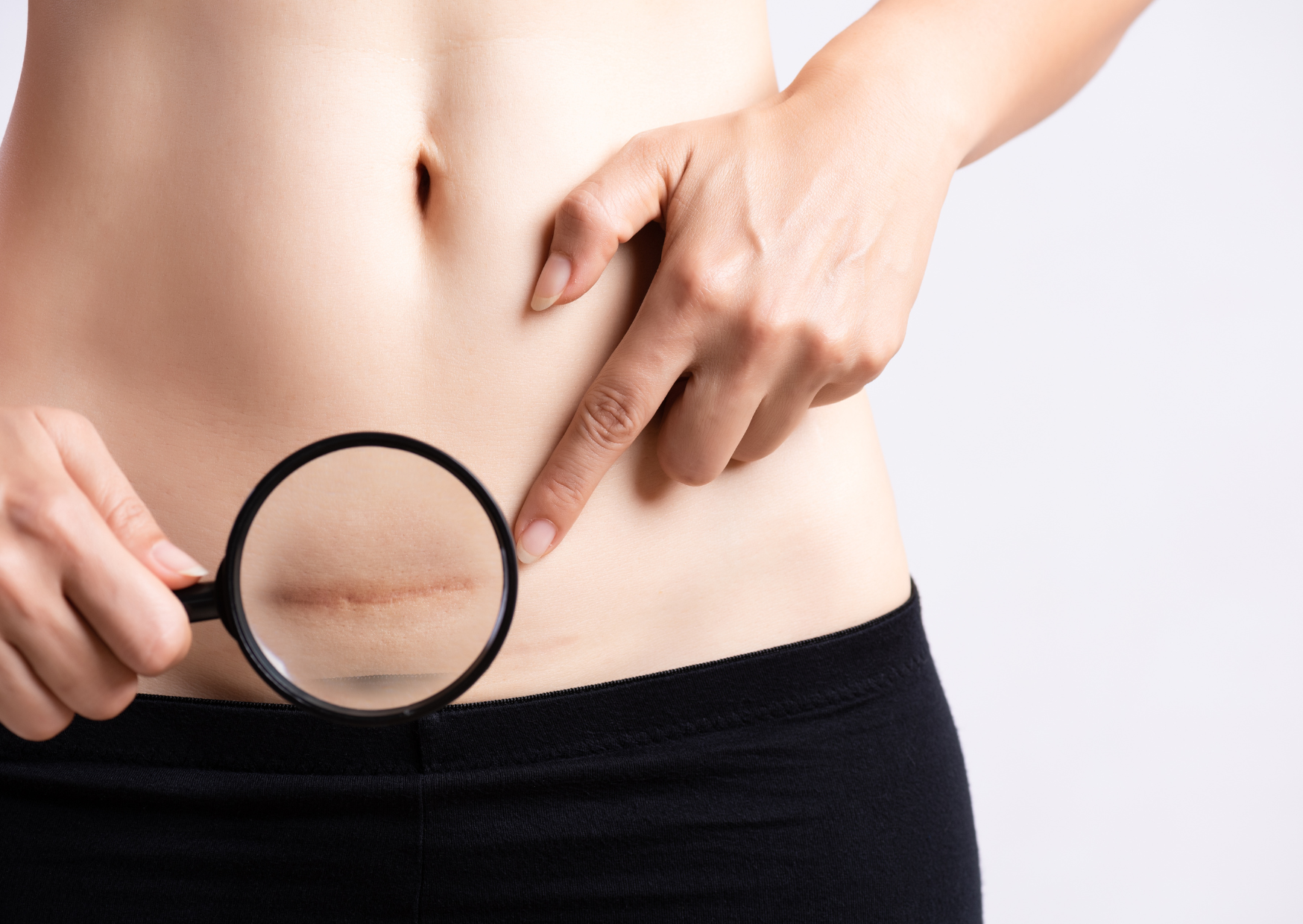 行銷剖腹產手術