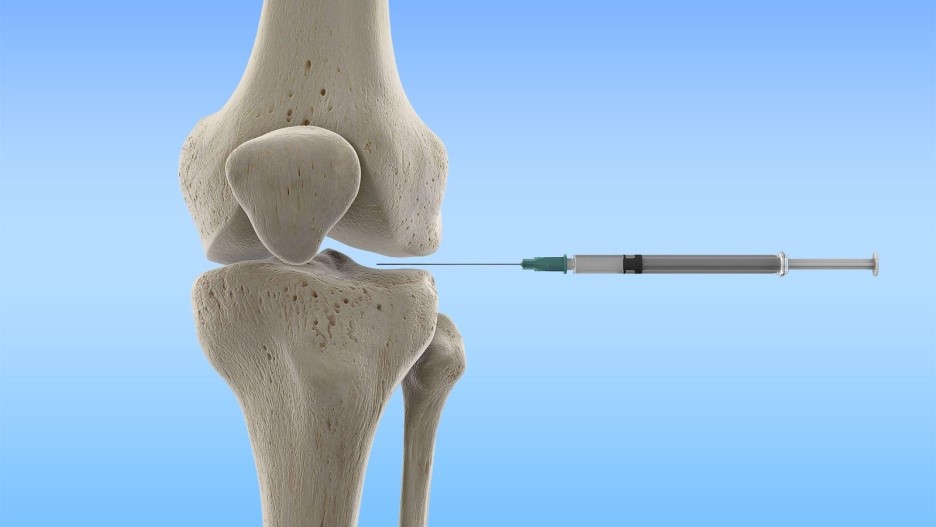 玻尿酸注射膝蓋骨關節炎？不，它們真的沒有幫助！