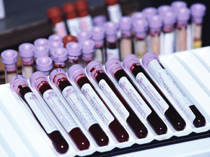 你的血型可能預示感染COVID-19的風險