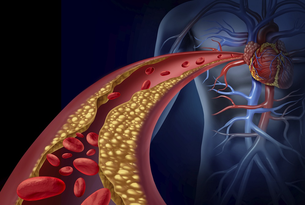 吃的膽固醇到底會不會影響心血管健康？