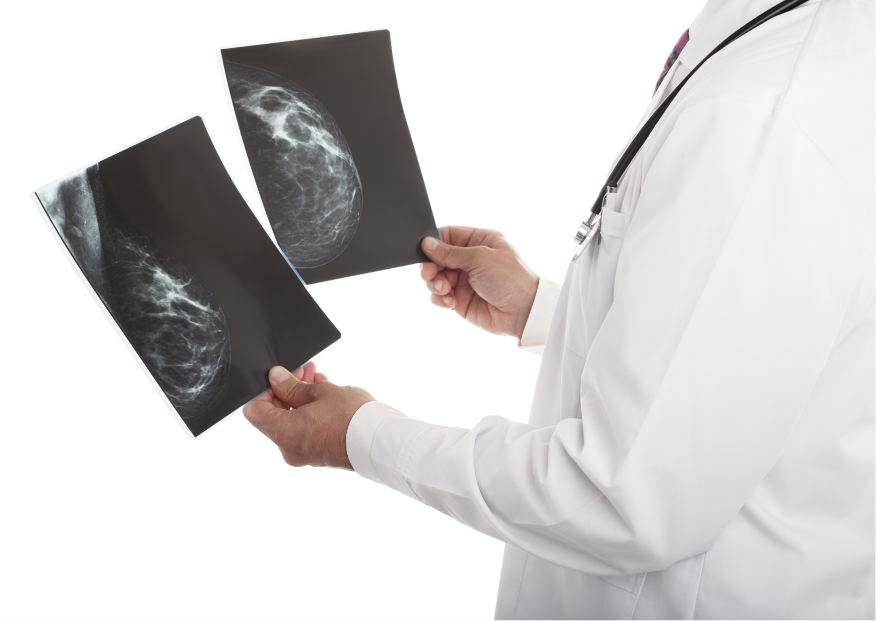 美FDA新規定：乳房X光報告需有乳房密度資訊
