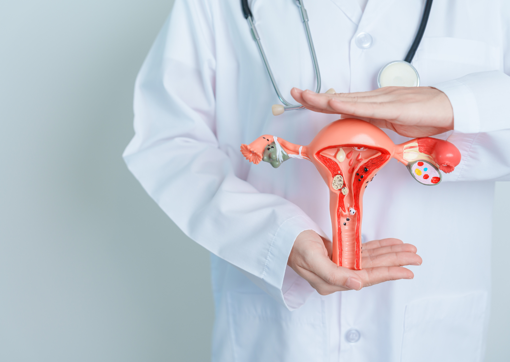 子宮內膜異位症增加卵巢癌風險