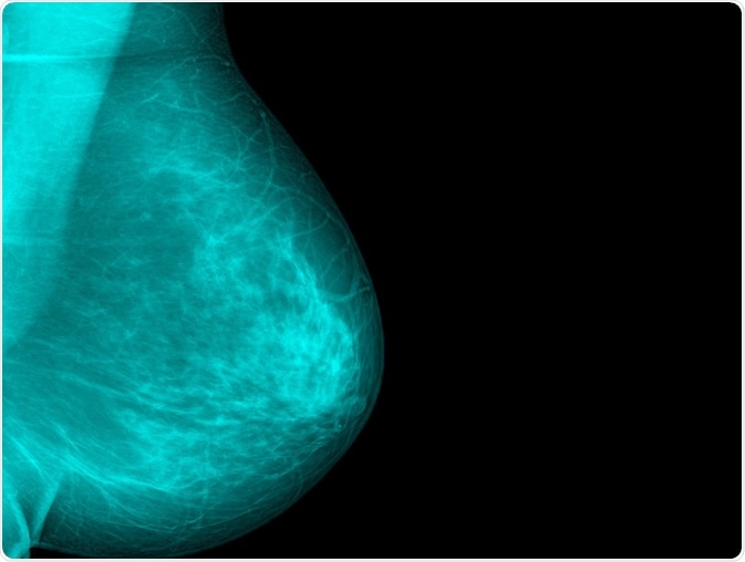 免於輻射暴露的乳癌篩檢